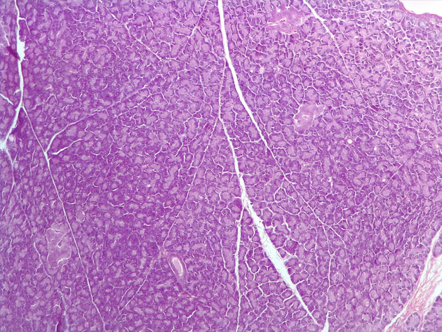 Pancreas Slides - Pancreas 015 400X